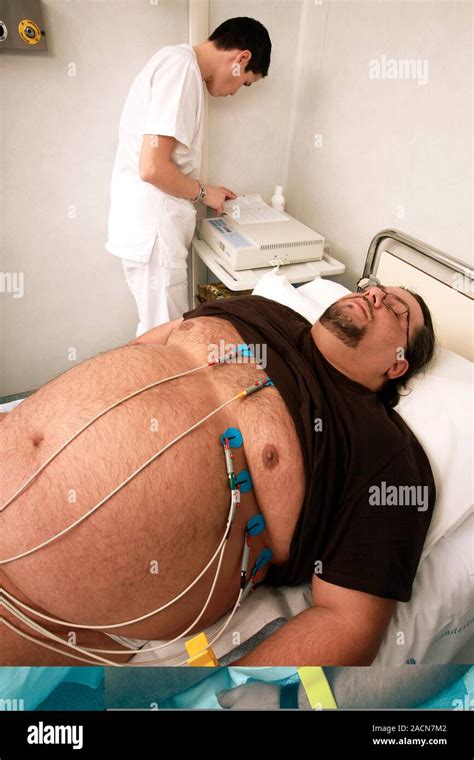 Obesity Clinic Male Patient Undergoing An Electrocardiography ECG