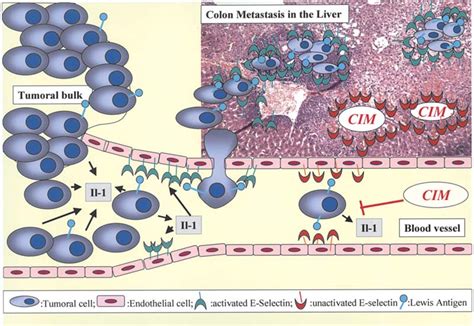 CIM Mediated Inhibition Of Cancer Cell Migration And The Development Of