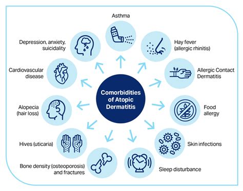 The Atopic March and Beyond – Other Health Issues Connected with Atopic ...