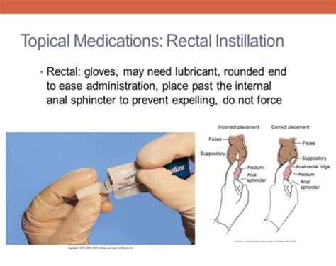 Medication Administration Flashcards Quizlet