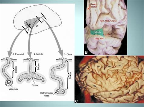 Insular lobe anatomy | PPT