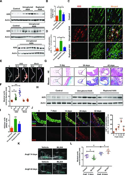 Klf Expression Is Down Regulated In The Ruptured Human And