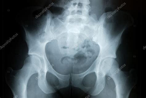 Pelvis X-ray — Stock Photo © _luSh_ #2333401