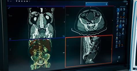 Intelig Ncia Artificial Na Radiologia Quais As Aplica Es