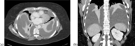 Acaption Representative Sections Of A Ct Scan Axial Section On The