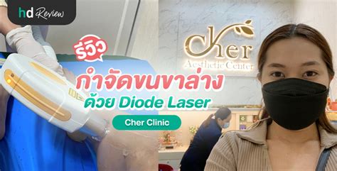 รีวิว กำจัดขนขาล่าง ด้วย Diode Laser ที่ Cher Clinic Hdmall