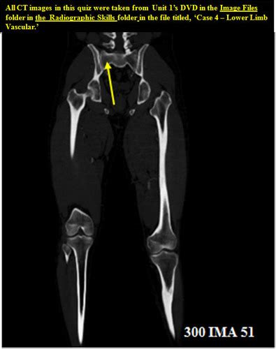 Radiology 2 Flashcards Quizlet