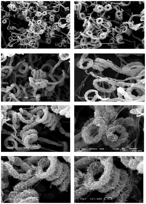 Scanning Electron Micrograph Showing The Spore Chain Morphology And