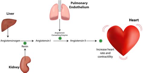 primary aldosteronism