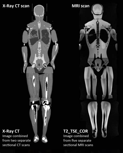 Full Body Phantom For Xray Mri Ct And Ultrasound