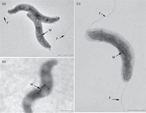 Transmission Electron Micrographs Of Negatively Stained Cells Of