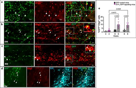 S1P1 Signaling In Oligodendrocytes Depicted By GFP Expression During