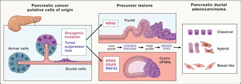 Pancreatic Cancer Advances And Challenges Cell