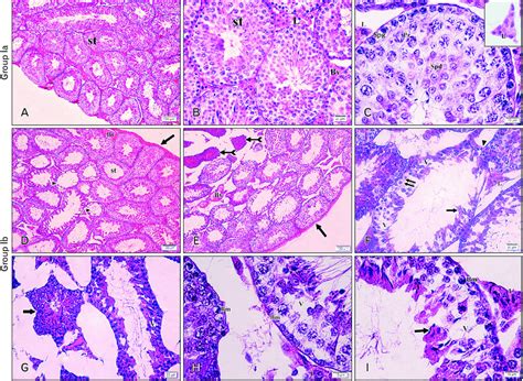 Photomicrographs Of A Sections Of The Testis From Mice Stained By Hande