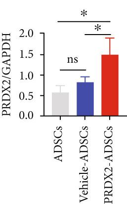 Characterization Of ADSCs And PRDX2 ADSCs A B Morphology Of ADSCs