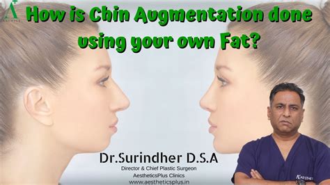 Chin Enhancement Augmentation Using Autologous Fat Drsurindher