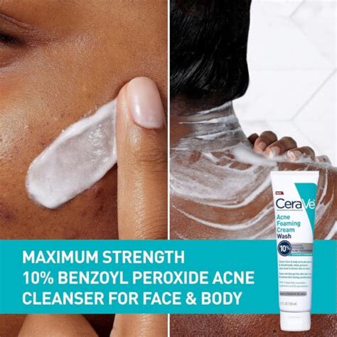 Cerave Acne Foaming Cream Wash Face And Body Acne Wash With Benzoyl