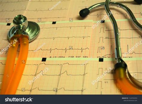 Healthy Concept Stethoscope Electrocardiogram Ecg Ekg Stock Photo