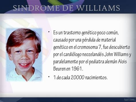 Sindrome De Williams