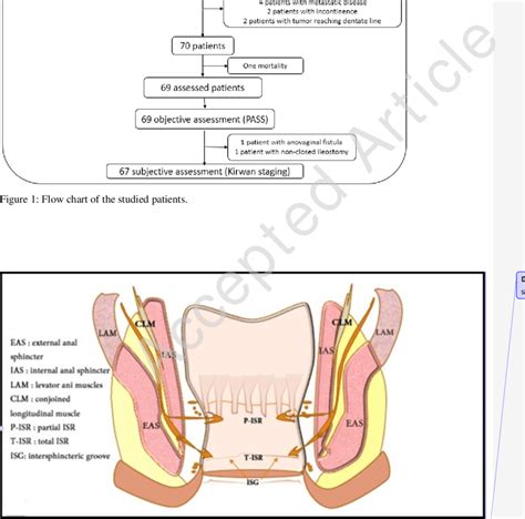 The Plane For Partial And Total Intersphincteric Resection In SSP For