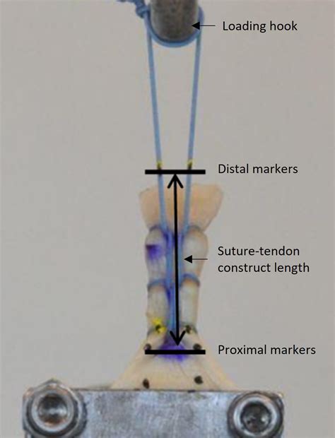 Biomechanical Characteristics Of A New Looping Stitch Versus The