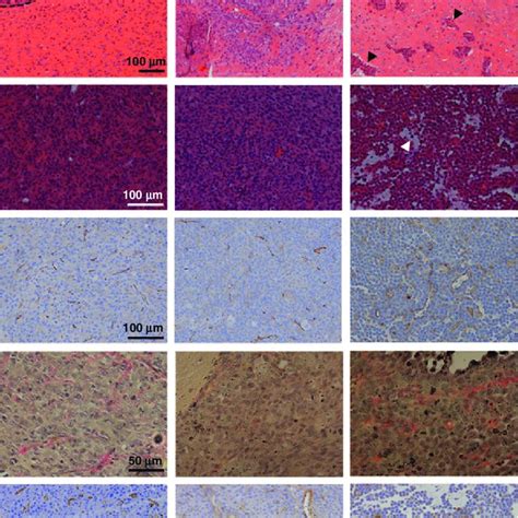 Noninvasive Imaging Of The Viscoelastic Properties Of Intracranial