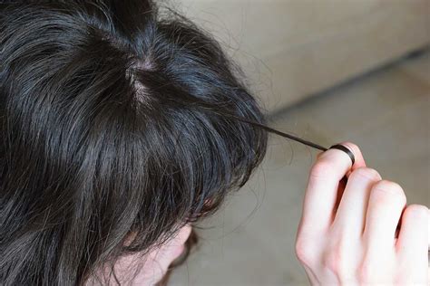 What Is Trichotillomania Female Hair Loss Help