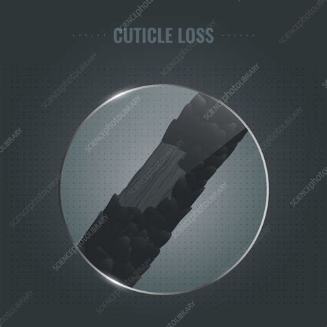 Damaged hair cuticle loss, illustration - Stock Image - F035/0188 ...