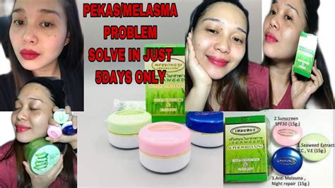 Meyyong Cream Review Pekas Melasma Problem Solve In Just 5 Days Mechelle Vlog Youtube