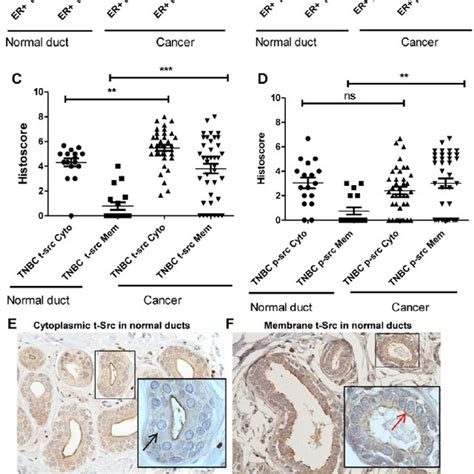 Src Expression In Breast Cancer Tissue And Adjacent Normal Ducts Of Er