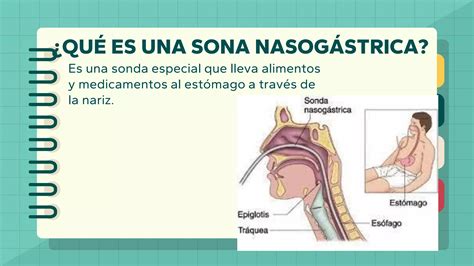 Colocaci N De Sonda Nasog Strica Ppt