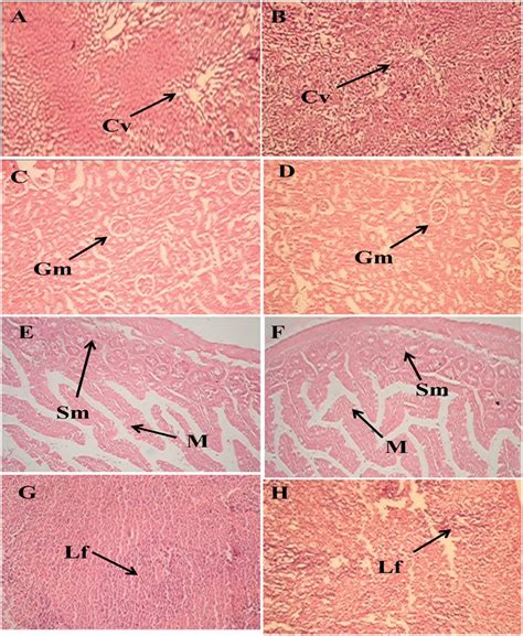 Representative Photomicrographs Of A Liver Group I B Liver