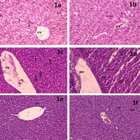 A A Photomicrograph Of A Cross Section Of The Liver Of A Rat Of Group