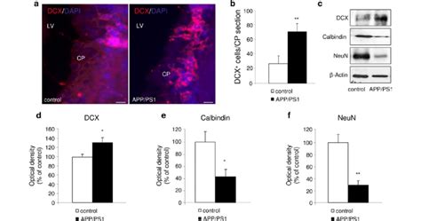 Cell Differentiation In The Choroid Plexus Of App Ps Mice A