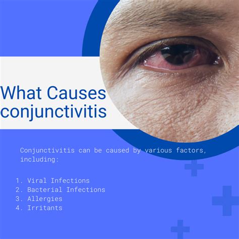 Conjunctivitis Pink Eye Understanding The Causes Symptoms And