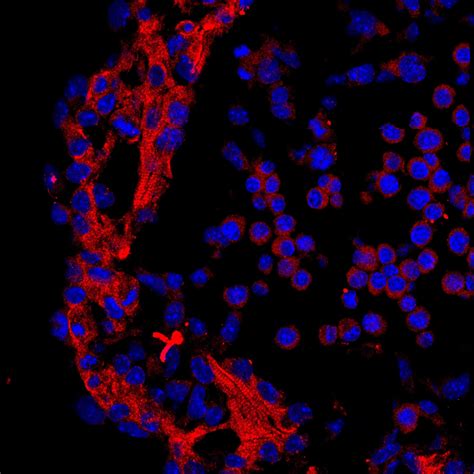 Cardiac Troponin T Antibody 15513 1 AP Proteintech