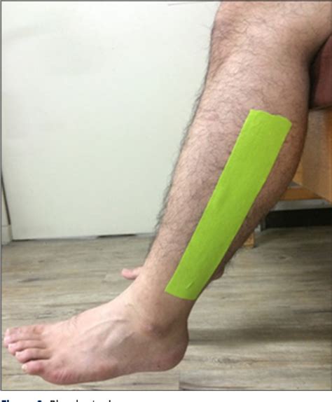 Figure 1 From Immediate Effects Of Ankle Balance Taping With