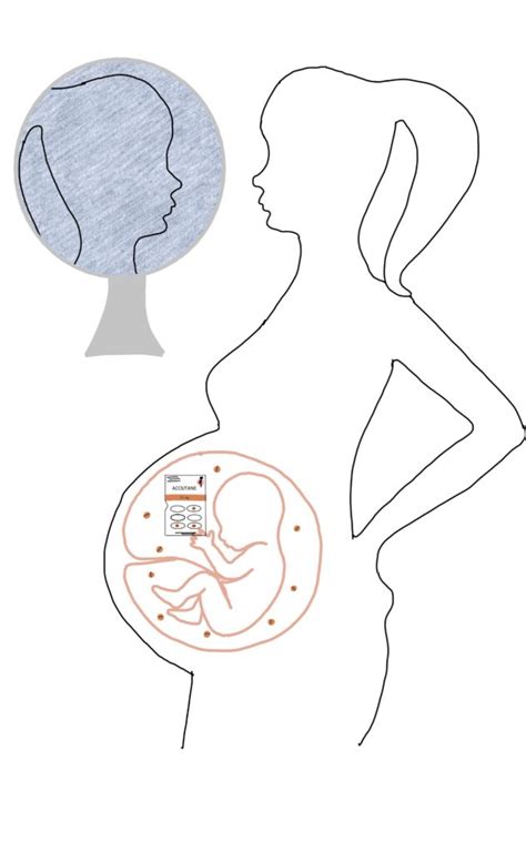 The Effects of Accutane on Pregnancy – Human STEAM