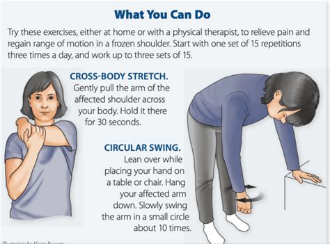 How To Fix A Frozen Shoulder Arthritis Advisor