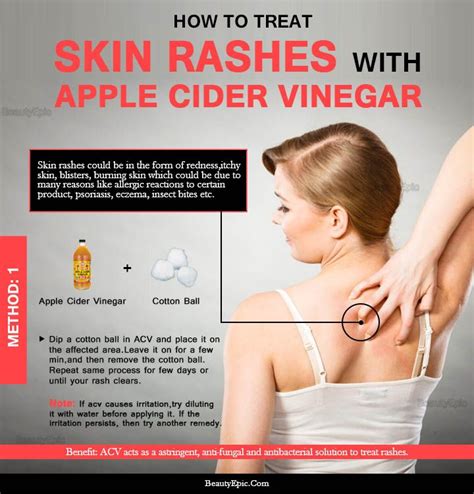 How To Use Apple Cider Vinegar For Skin Rash Apple Cider Vinegar For Skin Skin Rash Apple