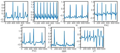 Sensors Free Full Text Artificial Intelligence Enabled Ecg