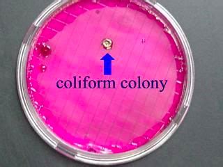 Surface Water: the Role of Fecal Coliform and Waterborne Pathogens