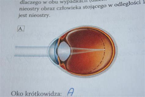 Na Ilustracji Przedstawiono Budow Oka Dalekowidza I Kr Tkowidza Wska