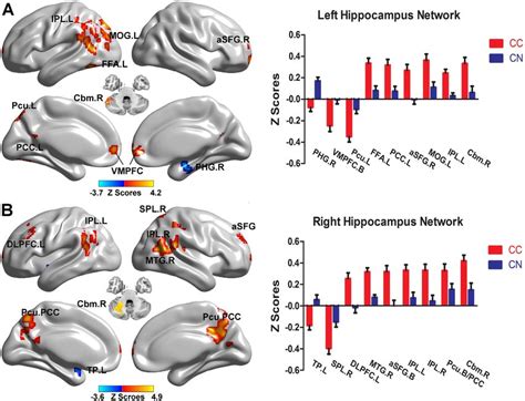 Brain Regions Showing Different Bilateral Hippocampal Functional