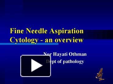 Ppt Fine Needle Aspiration Cytology An Overview Powerpoint