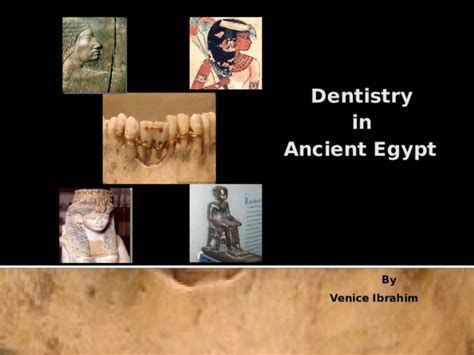 Dentistry in Ancient Egypt