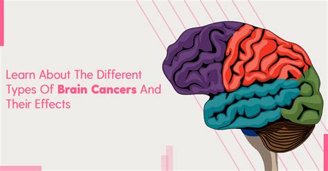 Brain Cancer Types University Cancer Centers