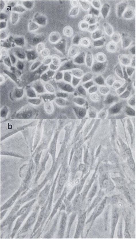 The Mesothelioma Cell Culture Obtained With Epithelial Growth Pattern