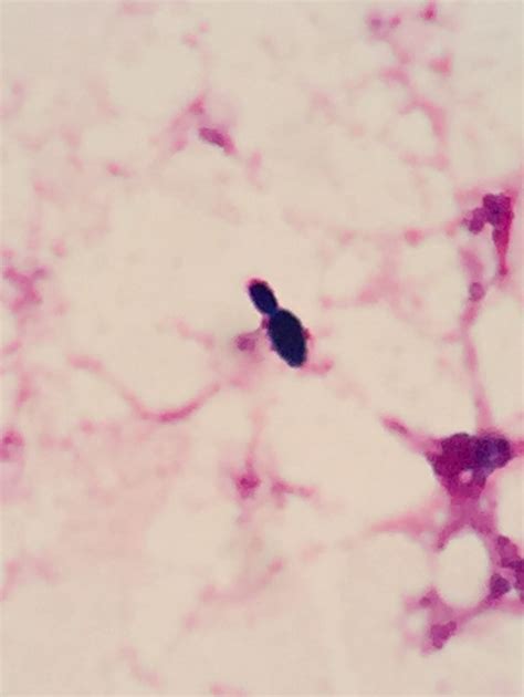 Peptostreptococcus micros〔口腔内嫌気性菌〕 | グラム染色: Gram Stain