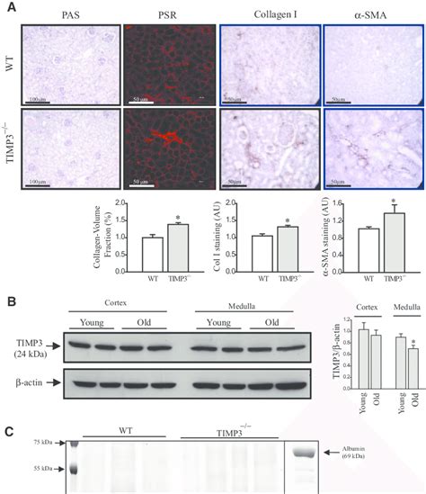 Loss Of Tissue Inhibitor Of Matrix Metalloproteinases Timp